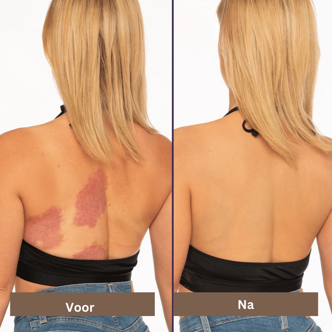 Waterproof Concealer | Abdecken von Flecken, Narben & Tattoos - Langanhaltend