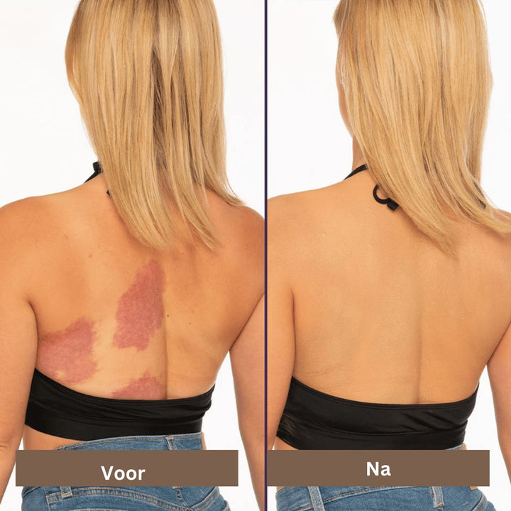 Waterproof Concealer | Abdecken von Flecken, Narben & Tattoos - Langanhaltend